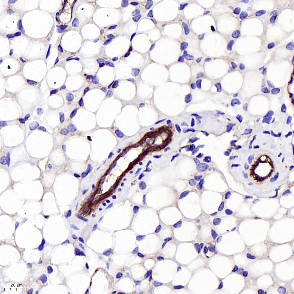 Anti -CD31 Rabbit pAb