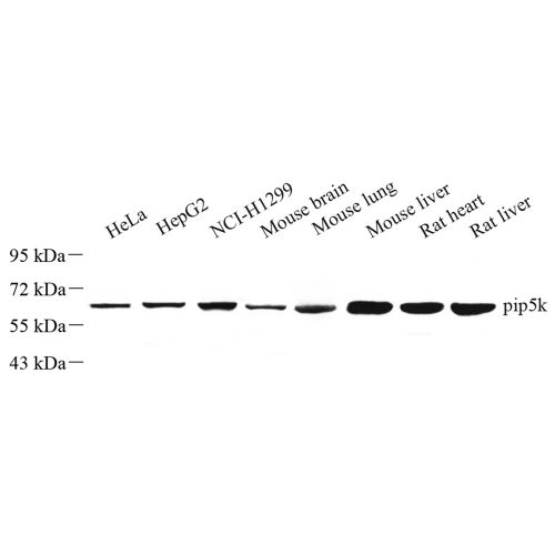 Anti -PIP5K1 alpha/PIP5K1A Rabbit pAb