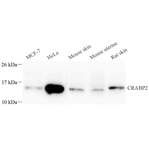 Anti -CRABP2 Rabbit pAb